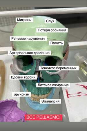Гирудотерапия