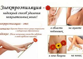 Электроэпиля́ция