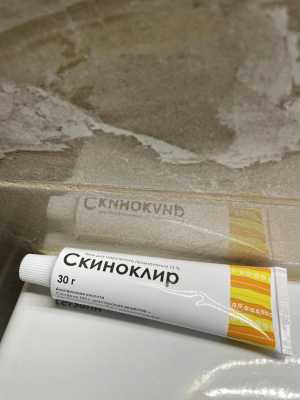 Скиноклир